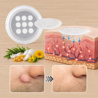 PURESHADE® Maximum Strength Wart Remover Patches 💧 Szemölcsök, talpi szemölcsök és bőrkinövések célzott ápolására | Egyszerű otthoni használat