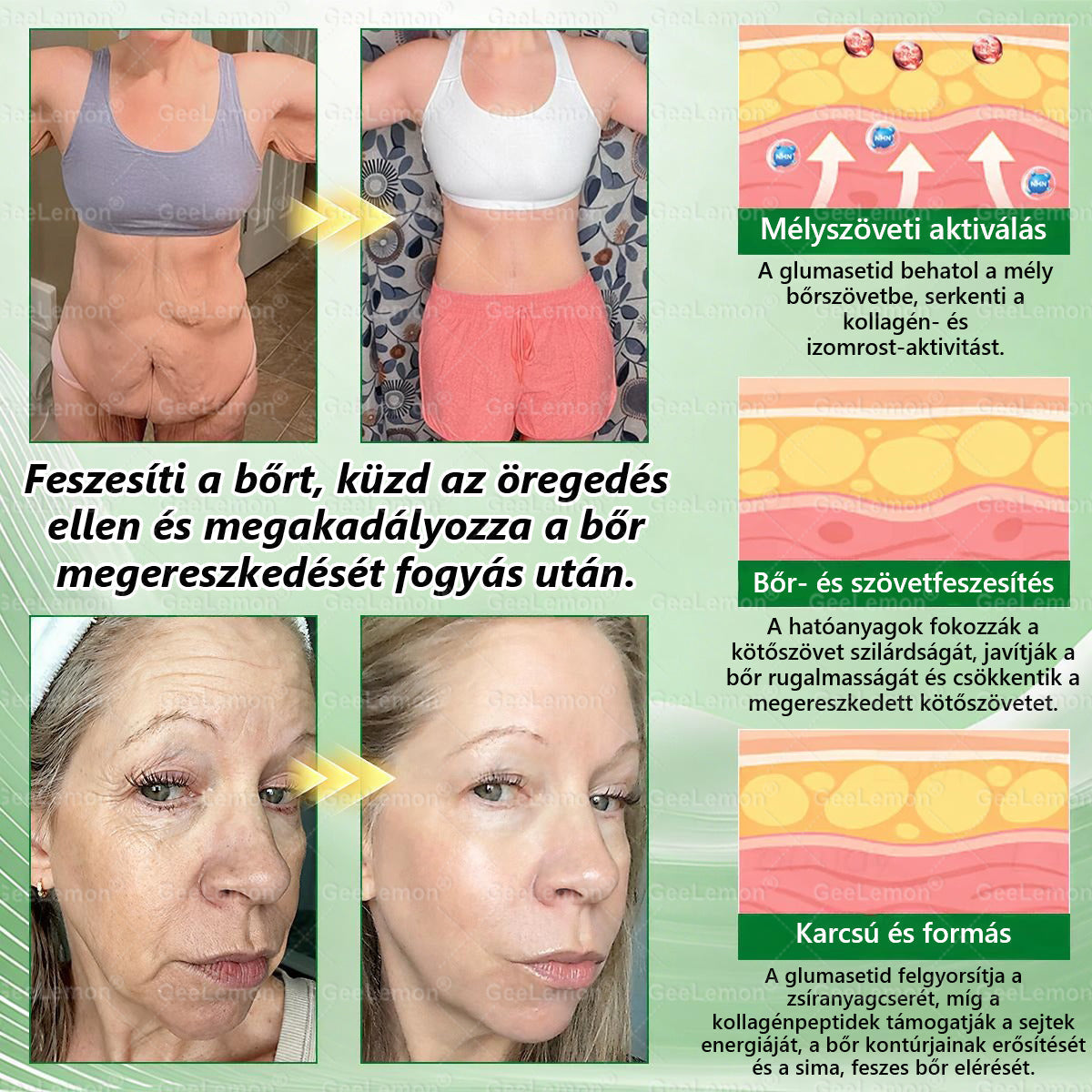GeeLemon® 10 az 1-ben Nano Mikrotűs Fogyókúrás Tapasz 🌿 Berberin + Moringa + NAD+ formula a természetes anyagcsere-támogatásért és testsúlykontrollért | Napi 1 egyszerű használat