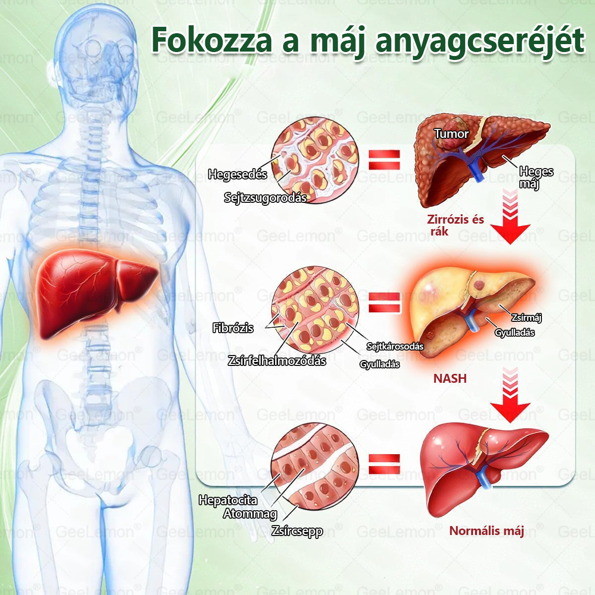 GeeLemon® 10 az 1-ben Nano Mikrotűs Fogyókúrás Tapasz 🌿 Berberin + Moringa + NAD+ formula a természetes anyagcsere-támogatásért és testsúlykontrollért | Napi 1 egyszerű használat