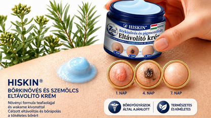 A 𝐇𝐢𝐬𝐤𝐢𝐧® különleges meglepetéssel készült számodra! Már most is nagyszerű ajánlatot kaptál, de most egy még kedvezőbb lehetőséget oldottál fel: a következő vásárlásodra óriási, 50%-os kedvezményt kapsz — kizárólag a következő két percben!