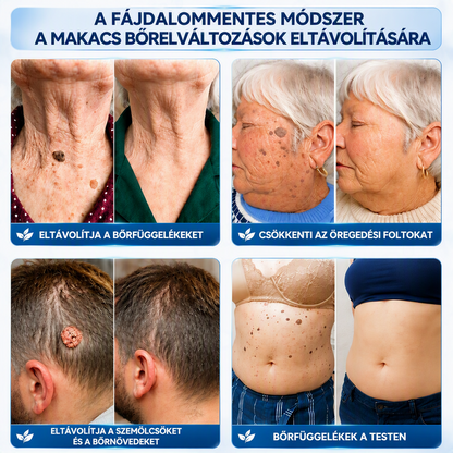 A 𝐇𝐢𝐬𝐤𝐢𝐧® különleges meglepetéssel készült számodra! Már most is nagyszerű ajánlatot kaptál, de most egy még kedvezőbb lehetőséget oldottál fel: a következő vásárlásodra óriási, 50%-os kedvezményt kapsz — kizárólag a következő két percben!
