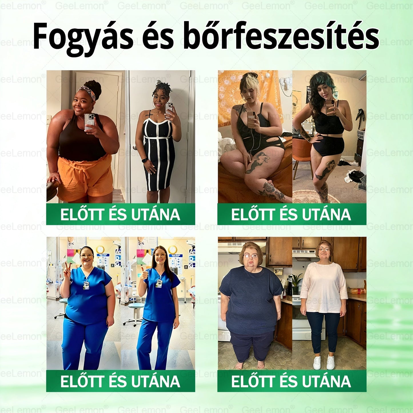 GeeLemon® 10 az 1-ben Nano Mikrotűs Fogyókúrás Tapasz 🌿 Berberin + Moringa + NAD+ formula a természetes anyagcsere-támogatásért és testsúlykontrollért | Napi 1 egyszerű használat