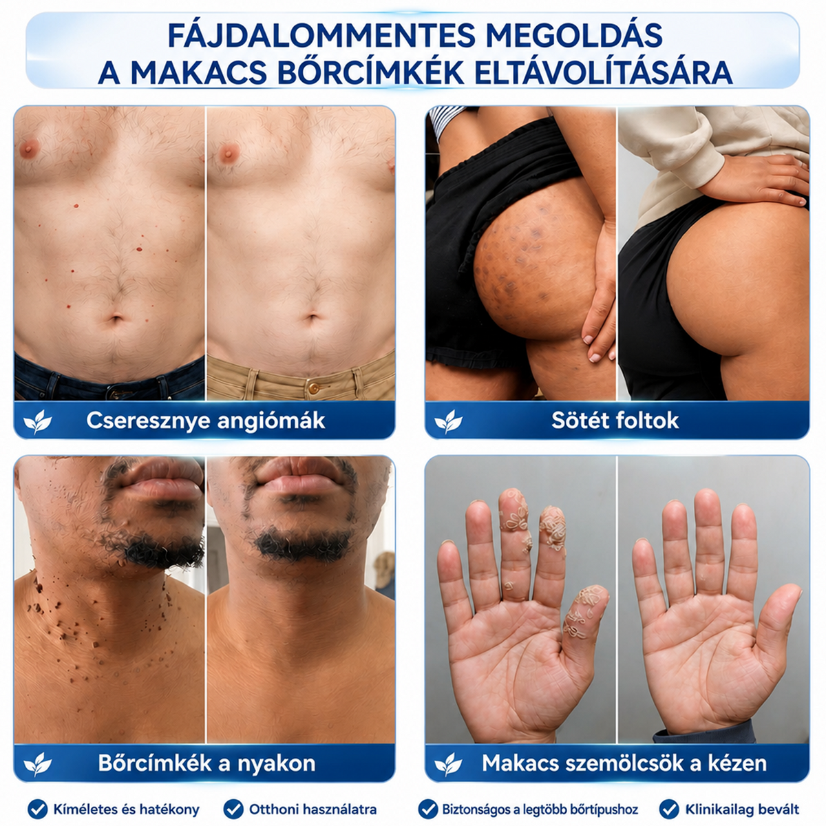 A 𝐇𝐢𝐬𝐤𝐢𝐧® különleges meglepetéssel készült számodra! Már most is nagyszerű ajánlatot kaptál, de most egy még kedvezőbb lehetőséget oldottál fel: a következő vásárlásodra óriási, 50%-os kedvezményt kapsz — kizárólag a következő két percben!