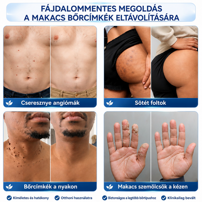 A 𝐇𝐢𝐬𝐤𝐢𝐧® különleges meglepetéssel készült számodra! Már most is nagyszerű ajánlatot kaptál, de most egy még kedvezőbb lehetőséget oldottál fel: a következő vásárlásodra óriási, 50%-os kedvezményt kapsz — kizárólag a következő két percben!