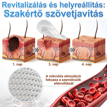PURESHADE® Maximum Strength Wart Remover Patches 💧 Szemölcsök, talpi szemölcsök és bőrkinövések célzott ápolására | Egyszerű otthoni használat