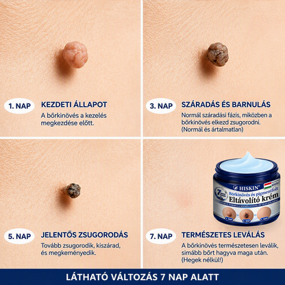 A 𝐇𝐢𝐬𝐤𝐢𝐧® különleges meglepetéssel készült számodra! Már most is nagyszerű ajánlatot kaptál, de most egy még kedvezőbb lehetőséget oldottál fel: a következő vásárlásodra óriási, 50%-os kedvezményt kapsz — kizárólag a következő két percben!