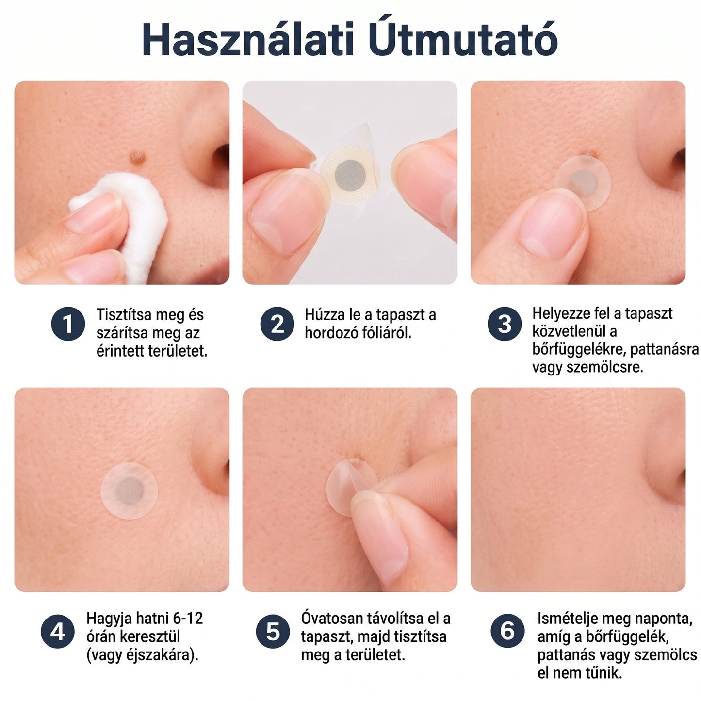 PURESHADE® Maximum Strength Wart Remover Patches 💧 Szemölcsök, talpi szemölcsök és bőrkinövések célzott ápolására | Egyszerű otthoni használat