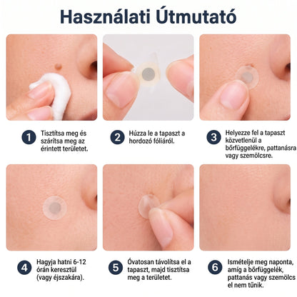 PURESHADE® Maximum Strength Wart Remover Patches 💧 Szemölcsök, talpi szemölcsök és bőrkinövések célzott ápolására | Egyszerű otthoni használat