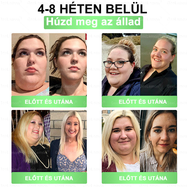 GeeLemon® 10 az 1-ben Nano Mikrotűs Fogyókúrás Tapasz 🌿 Berberin + Moringa + NAD+ formula a természetes anyagcsere-támogatásért és testsúlykontrollért | Napi 1 egyszerű használat