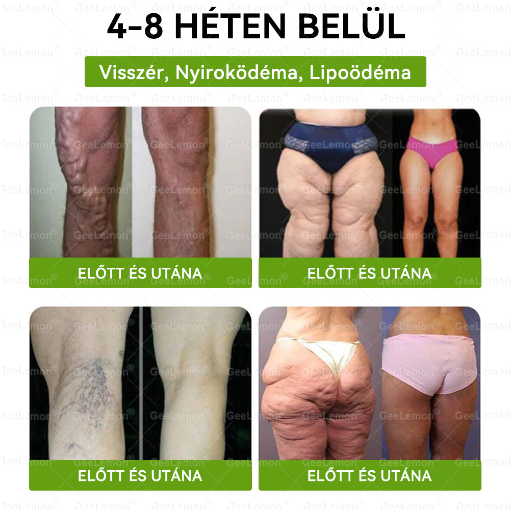 GeeLemon® 10 az 1-ben Nano Mikrotűs Fogyókúrás Tapasz 🌿 Berberin + Moringa + NAD+ formula a természetes anyagcsere-támogatásért és testsúlykontrollért | Napi 1 egyszerű használat