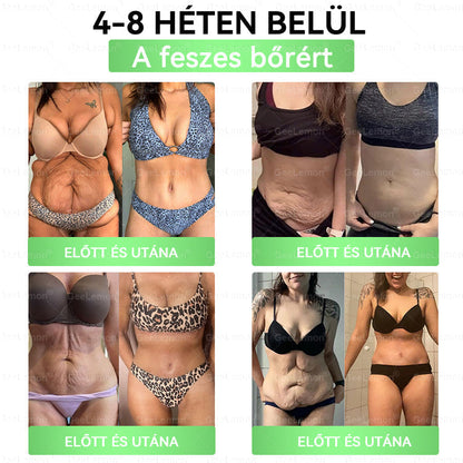 GeeLemon® 10 az 1-ben Nano Mikrotűs Fogyókúrás Tapasz 🌿 Berberin + Moringa + NAD+ formula a természetes anyagcsere-támogatásért és testsúlykontrollért | Napi 1 egyszerű használat
