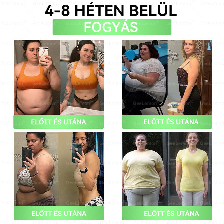 GeeLemon® 10 az 1-ben Nano Mikrotűs Fogyókúrás Tapasz 🌿 Berberin + Moringa + NAD+ formula a természetes anyagcsere-támogatásért és testsúlykontrollért | Napi 1 egyszerű használat